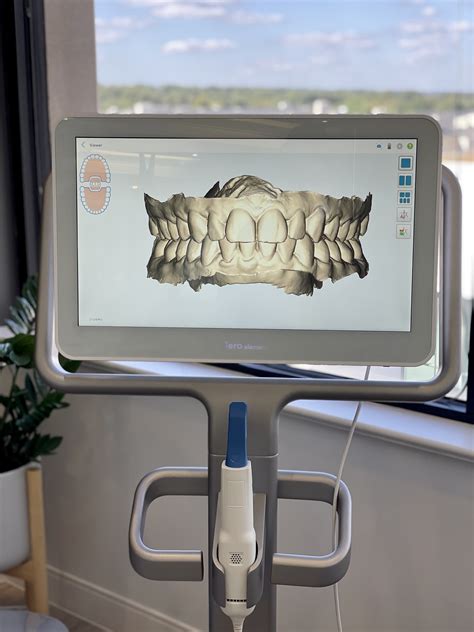 Image result for Invisalign Scanning Step by Step