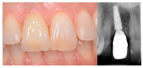 A Proposed Protocol for Ordinary and Extraordinary Hygienic Maintenance ...