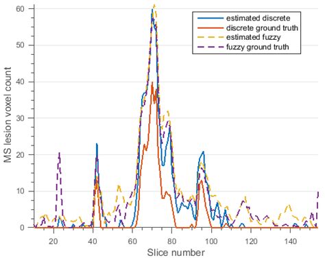 Automated Segmentation of MS Lesions in MR Images Based on an ...