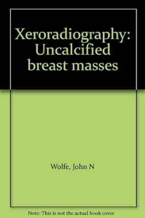 Xeroradiography: Uncalcified breast masses : Amazon.in: Books