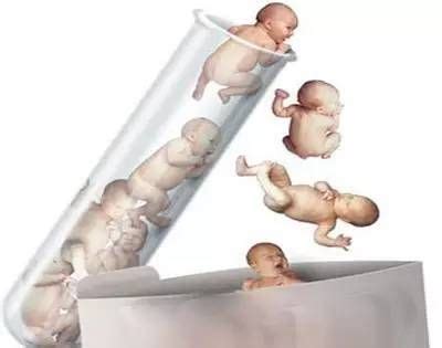 回顾试管婴儿历史，从1978年世界第一例到1988中国第一例...-孕多多