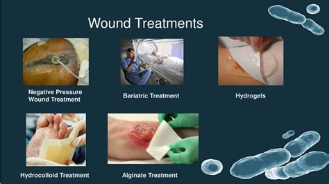Wound Care Treatments , Wound Care in Brandon and Carrollwood – RPKK