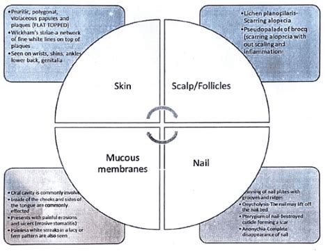 Lichen Planus - Medical Science Optional Notes for UPSC PDF Download