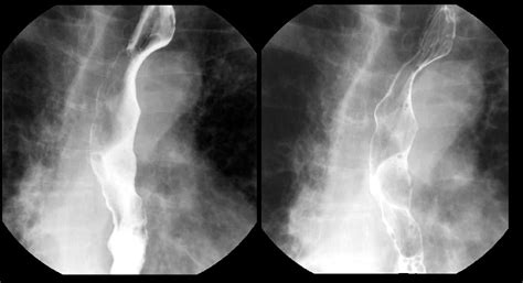 Radioloksabha - Articles