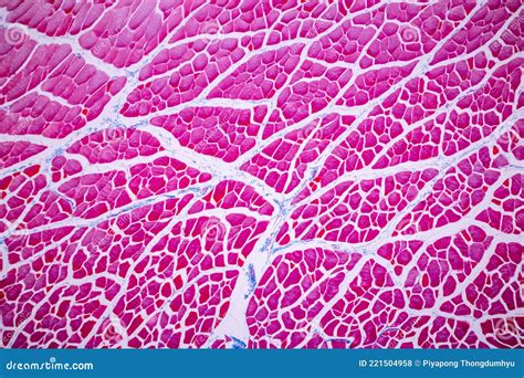 Image result for Skeletal Muscle Tissue Under Microscope