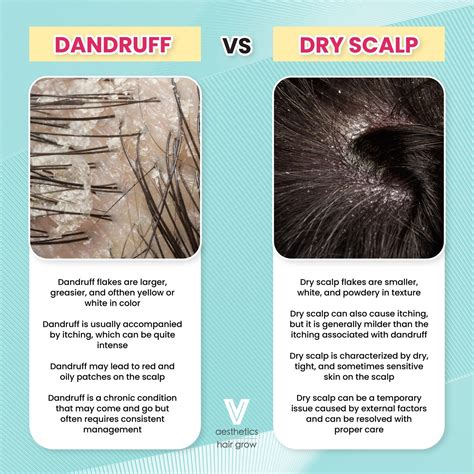 Dandruff Flakes Vs Dry Scalp Flakes