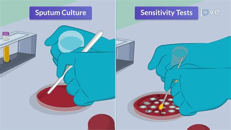 Video: Sputum Studies II: Culture and Sensitivity