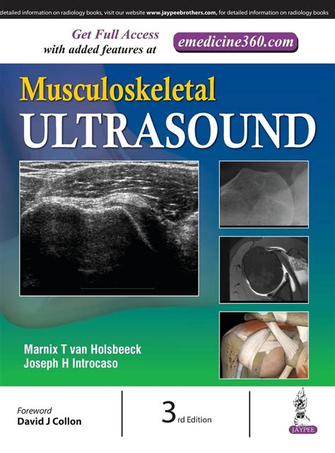 Buy Musculoskeletal Ultrasound Book Online at Low Prices in India ...
