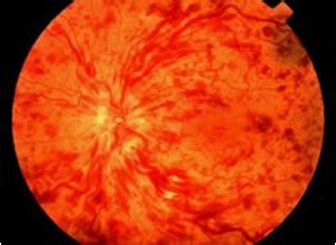 Nandini Eye Care Centre