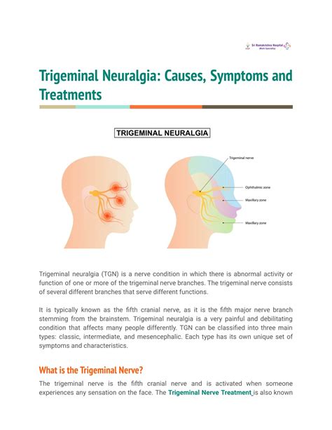 PPT - Trigeminal Neuralgia: Causes, Symptoms and Treatments PowerPoint Presentation - ID:11607382