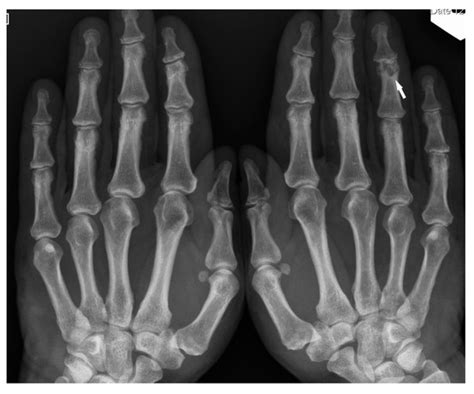 Imaging Plays a Key Role in the Diagnosis and Control of the Treatment ...