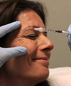 Best Botox Injection Treatment in Nagercoil for Wrinkles