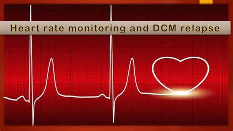 Heart rate monitoring can predict DCMP relapse after treatment ...