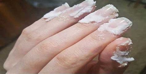 These 5 Easy Manicure Steps Will Help You To Grow Your Nails Faster ...