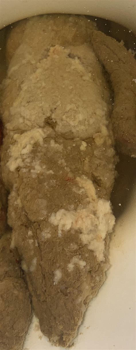 Stool With White Fatty Substance Mucus In Stool: What Causes It?