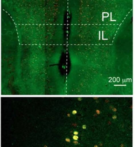 Image result for Prefrontal Cortex Mouse Brain
