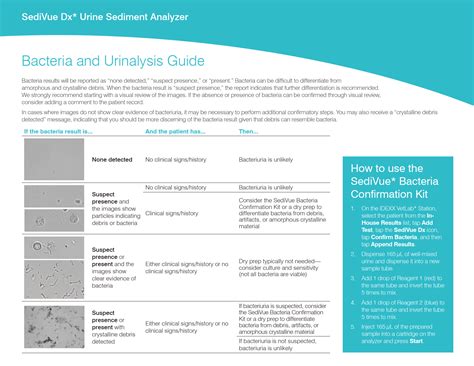 IDEXX 4Dx Plus SNAP Test Kits User Guide