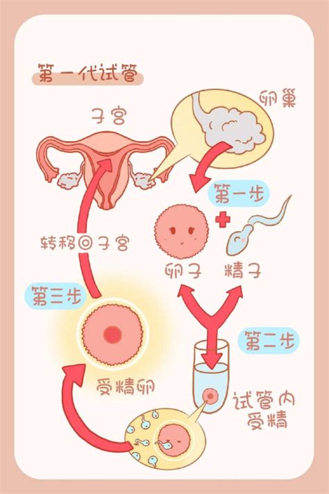 做试管婴儿你一定要知晓的6个步骤及准备工作_妈眯缘助孕