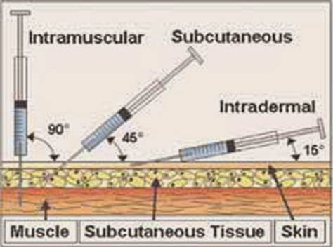 Angle of Injection 的图像结果