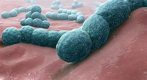 Pneumonia Detection for Everyone and Anyone under $100