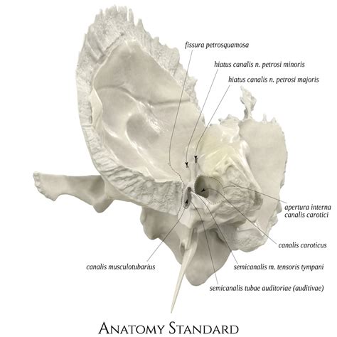 Petrous Bone Anatomy Surgical Anatomy Of The Temporal Bone