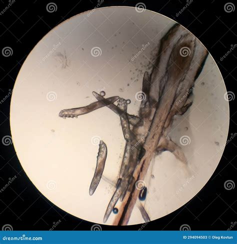 Demodex Folliculorum - Parasitic Mite on the Eyelashes of a Human Eye Stock Image - Image of ...