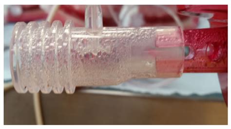 Development of a CO2 Sensor for Extracorporeal Life Support Applications