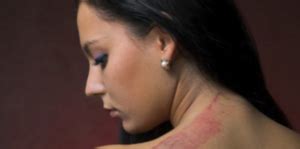 Image result for Famous Cases of Strangulation