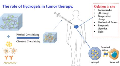 Injectable Hydrogels for Targeted Cancer Treatment