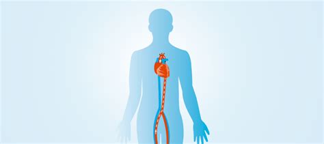 What Is Severe Aortic Stenosis? - Boston Scientific