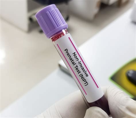 Early Gender Testing – Read Before You Book