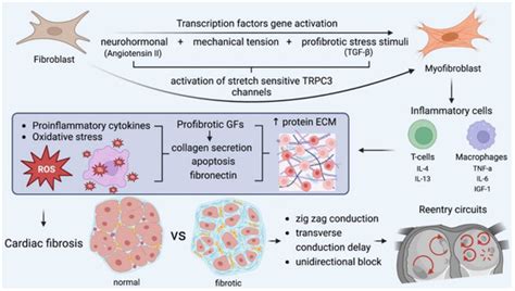 Mechanisms of Atrial Fibrillation: How Our Knowledge Affects Clinical ...