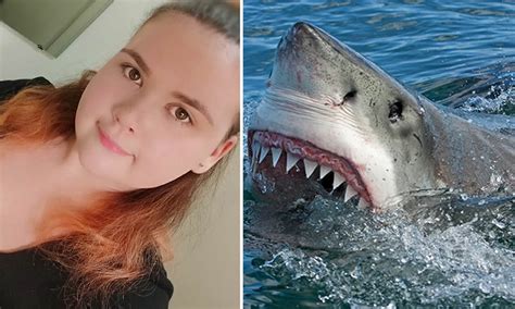 Great White Sharks Attacks Injuries 3,000 Year Old Shark Attack Left