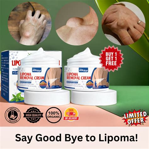 Herbal Lipoma Removal Cream (Buy 1 Get 1 Free🔥🔥) – QUIRKY BHARAT