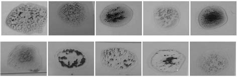 An Efficient System for Automatic Blood Type Determination Based on ...