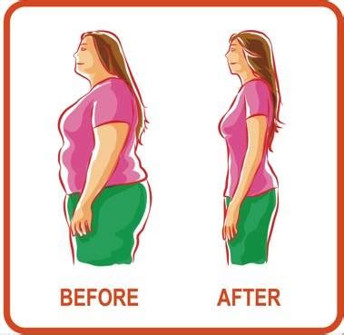 Fat Reduction Procedures Overview