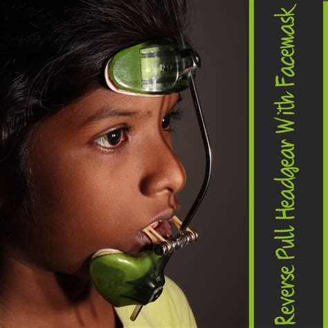 Dr.Arya S Prasad on LinkedIn: Reverse Pull Headgear