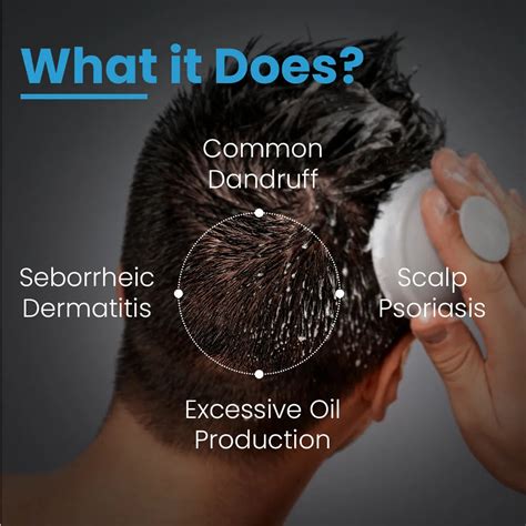 FCL T-Shampoo | Anti-Dandruff Scalp Formula – FCL Skincare