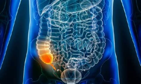 Image result for Appendicitis