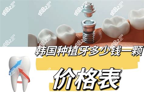 2019年上海种植牙价格表！收费详情一览！_千颜网
