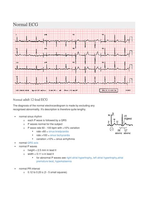 Normal ECG Read Out 的图像结果