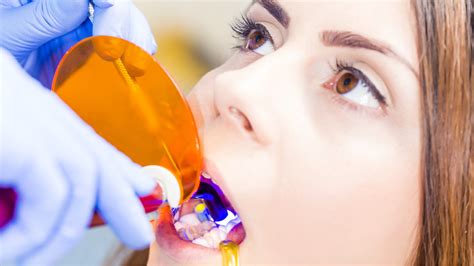 Everything You Should Know About Cosmetic Dental Bonding