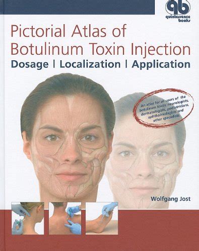 Buy PICTORIAL ATLAS OF BOTULINUM TOXIN INJECTION Book Online at Low ...
