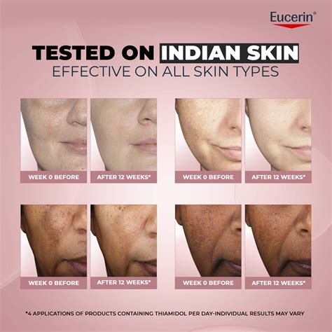 Buy Eucerin Anti-Pigment Dual Serum With Thiamidol & Hyaluronic Acid ...