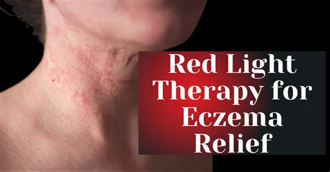 Red Light Therapy for Eczema Relief – KOZE Health