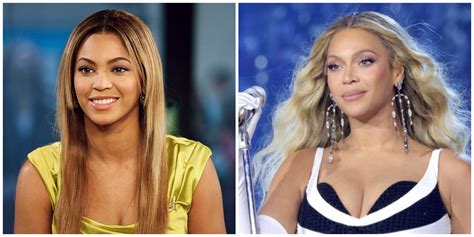 Beyoncé Plastic Surgery: Doc Says Singer Has Had Rhinoplasty and Breast ...