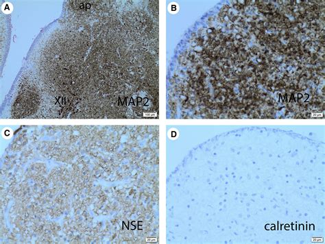 Area Postrema: Fetal Maturation, Tumors, Vomiting Center, Growth, Role in Neuromyelitis Optica ...