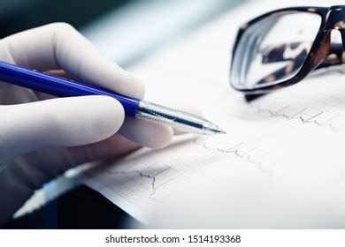 Image result for Normal vs Abnormal ECG