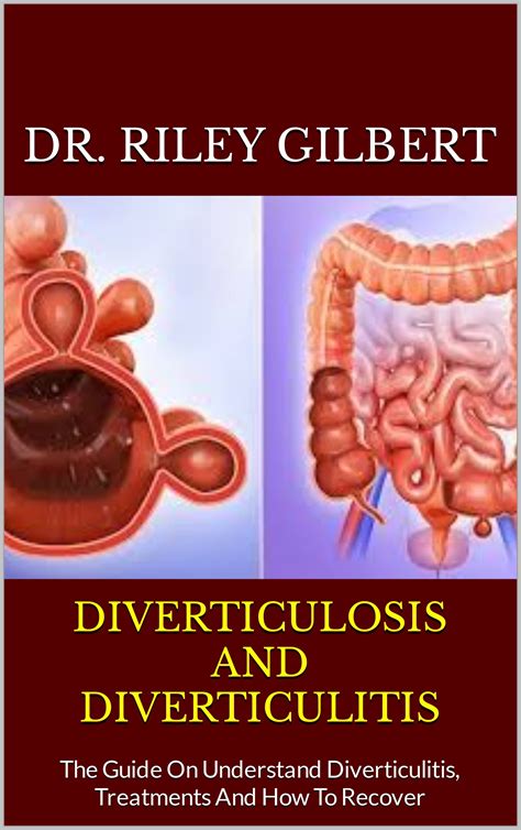 Diverticulosis And Diverticulitis The Guide On Understand ...