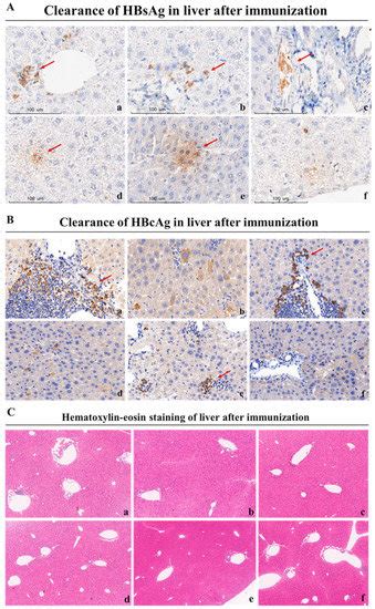Vaccines | Special Issue : Efficacy, Safety, and Immunogenicity of ...